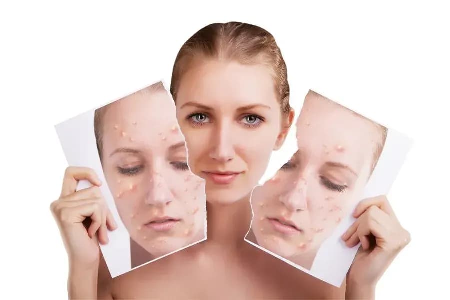 Beauty-Termin zur Hautanalyse in Krems